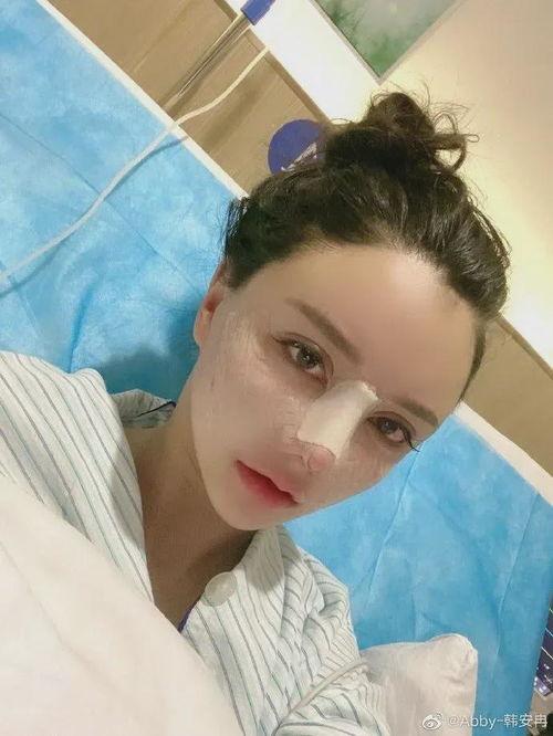 整容爆料大全视频播放,揭秘“整容爆料大全”视频播放背后的真相