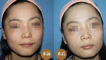 徒手祛斑爆料视频,视频爆料带你轻松告别斑点困扰